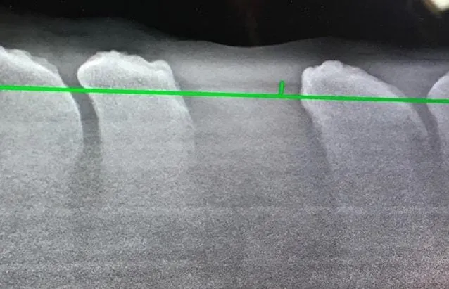 Kissing spines: Watch as a horse undergoes surgery and becomes rideable again